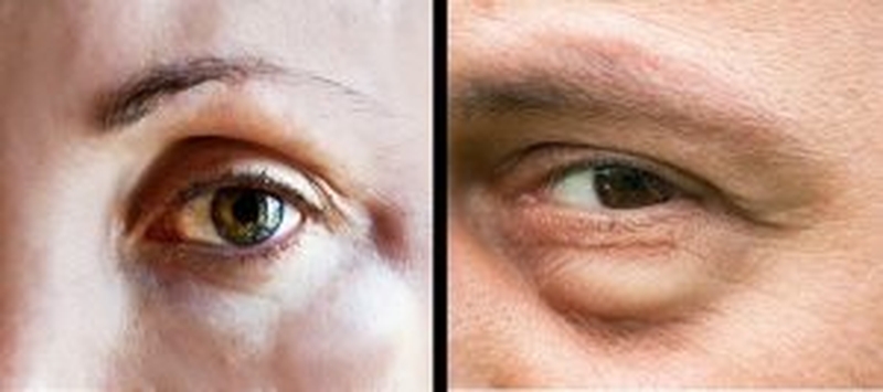 3 dau-hieu-bi-di-ung-quan-trong-thuong-gap-ma-ban-nen-biet 3