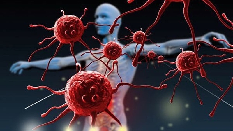 cac-giai-doan-ung-thu-da-cach-luu-y-va-danh-gia-ung-thu-da 3