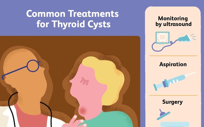 3 cách điều trị tuyến giáp có nang hiệu quả nhất hiện nay! 4