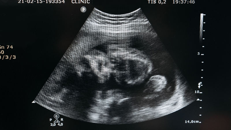 Sự phát triển của khoa học công nghệ giúp xác định giới tính thai nhi sớm, từ đó tạo điều kiện cho hành vi lựa chọn giới tính trước sinh và làm gia tăng mất cân bằng giới tính