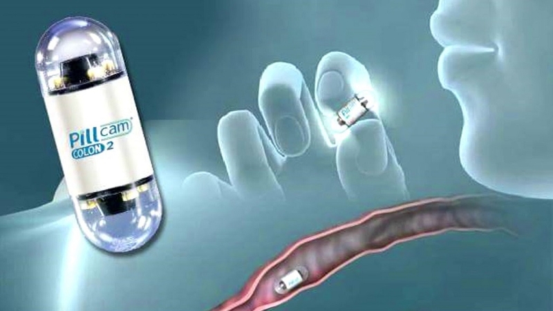 Kỹ thuật nội soi bằng viên nang cho phép bác sĩ nhìn thấy ruột, ruột non, ruột già, tá tràng và những khu vực khó tiếp cận bằng nội soi thông thường