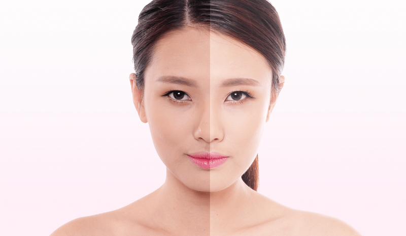 3 phương pháp trị sạm da đơn giản tại nhà