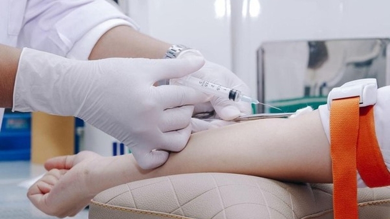 Xét nghiệm HLA B27 là gì? Tại sao cần làm xét nghiệm HLA B27?+3