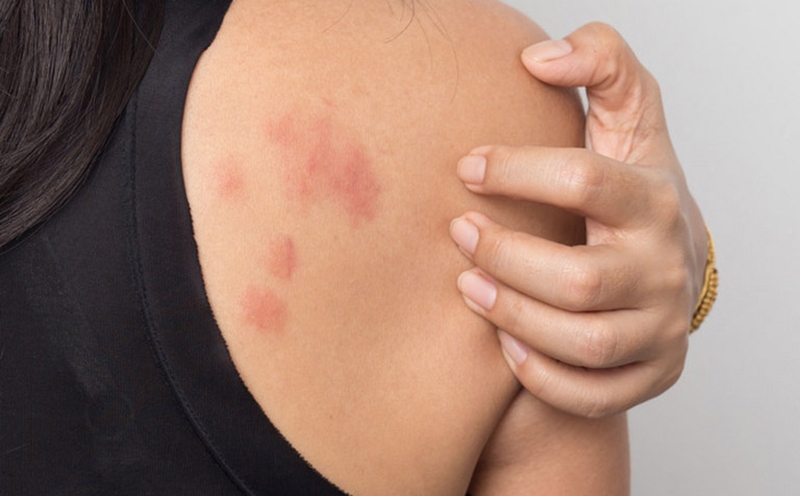 Nguyên nhân nào gây ra tình trạng hắt hơi liên tục? 4