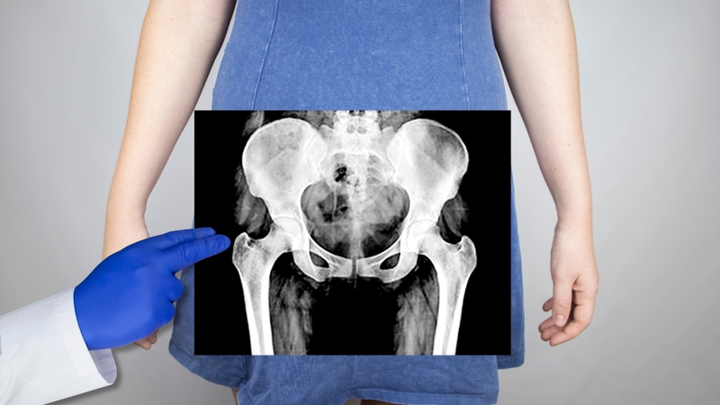 các bệnh phụ khoa thường gặp ở phụ nữ 4