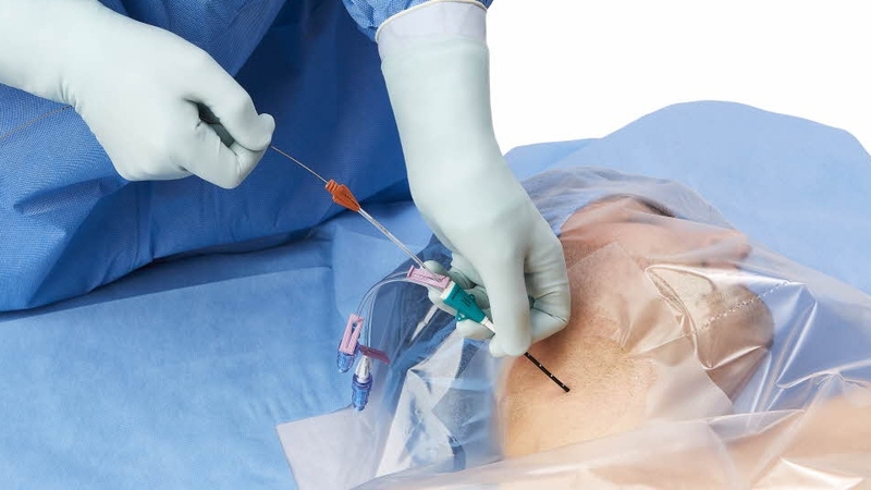 Những nguy cơ tiềm ẩn khi tự truyền dịch tại nhà 4