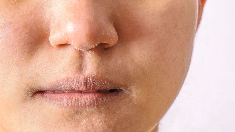 4 bước chăm sóc giúp khắc phục tình trạng da mặt khô rát hiệu quả 1