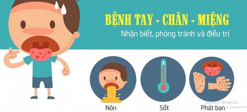 4 cấp độ của bệnh tay chân miệng và cách điều trị hiệu quả