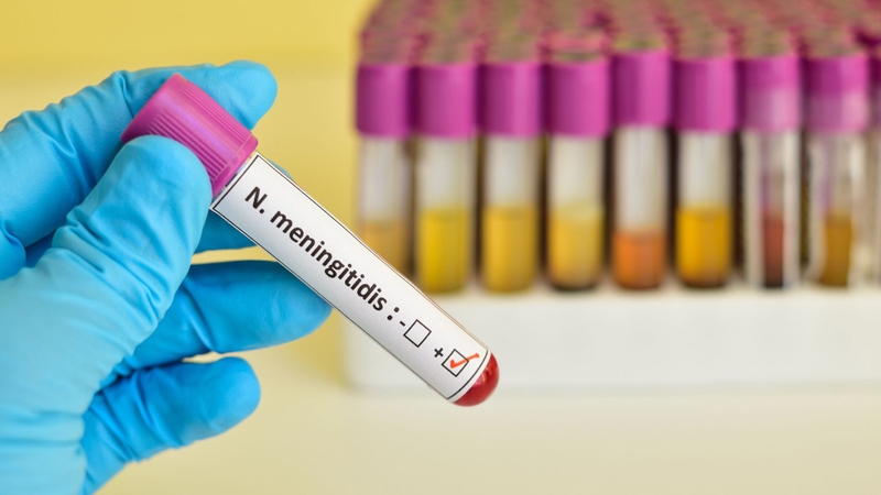 Nhiễm bệnh do não mô cầu là bệnh lý do vi khuẩn Neisseria meningitidis gây ra
