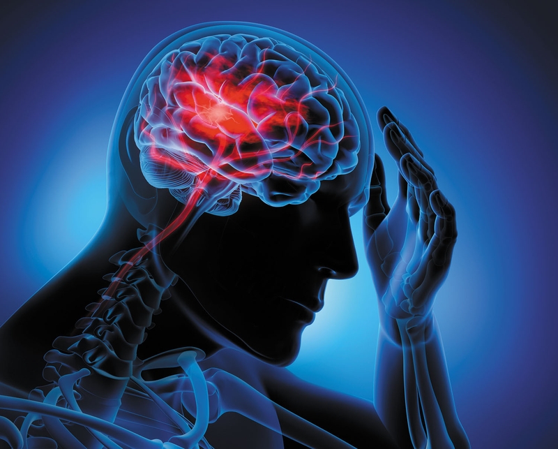 Cơn thiếu máu não thoáng qua có nguy hiểm không? 3