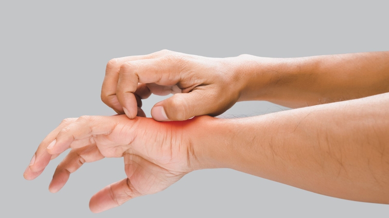 Một số người nhạy cảm có thể bị nổi mề đay, ngứa, phát ban