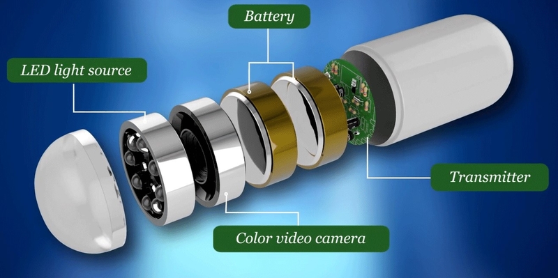 4 phương pháp kiểm tra đường tiêu hóa của bạn 4