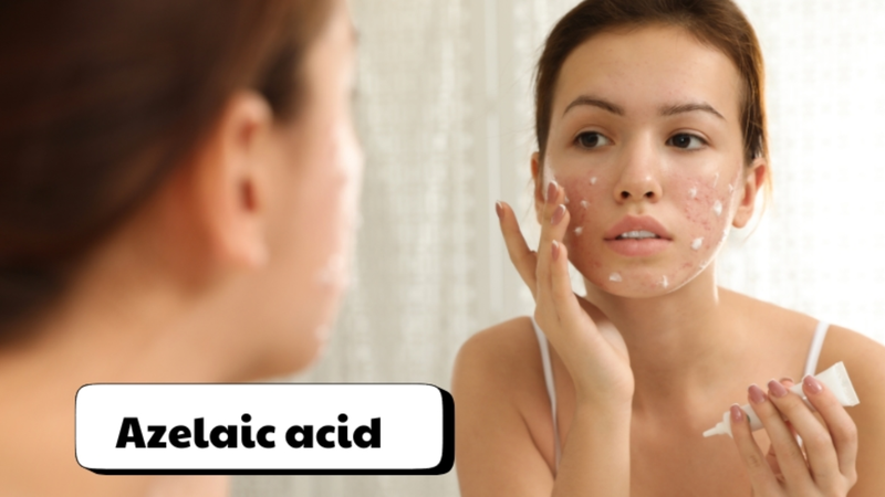 4 thành phần trị tàn nhang được chuyên gia khuyên dùng 3