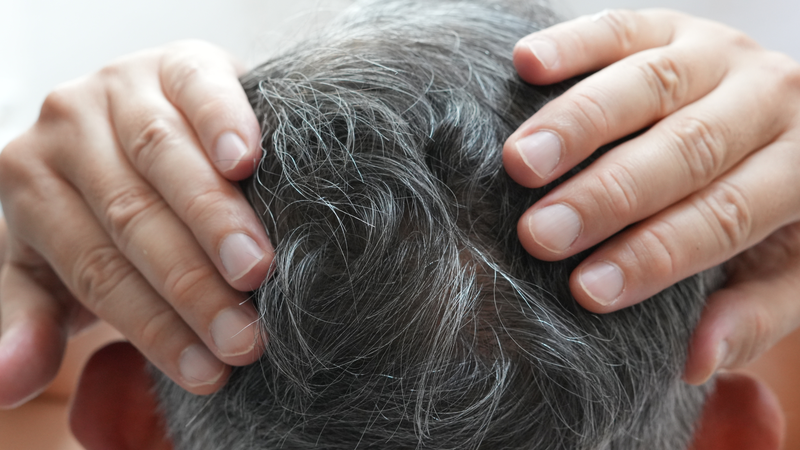 Cơ chế hình thành tóc bạc liên quan sắc tố melanin
