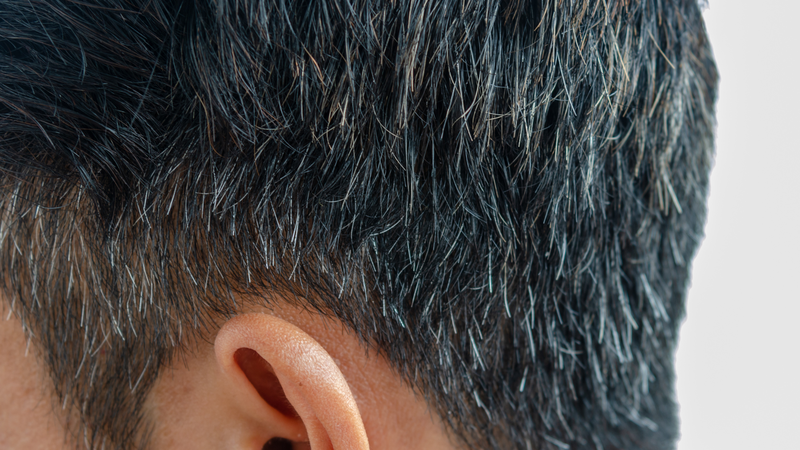 Tóc bạc sớm có thể cần theo dõi thêm