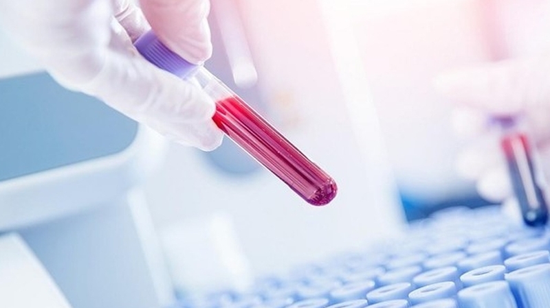 Xét nghiệm HLA B27 là gì? Tại sao cần làm xét nghiệm HLA B27?+4