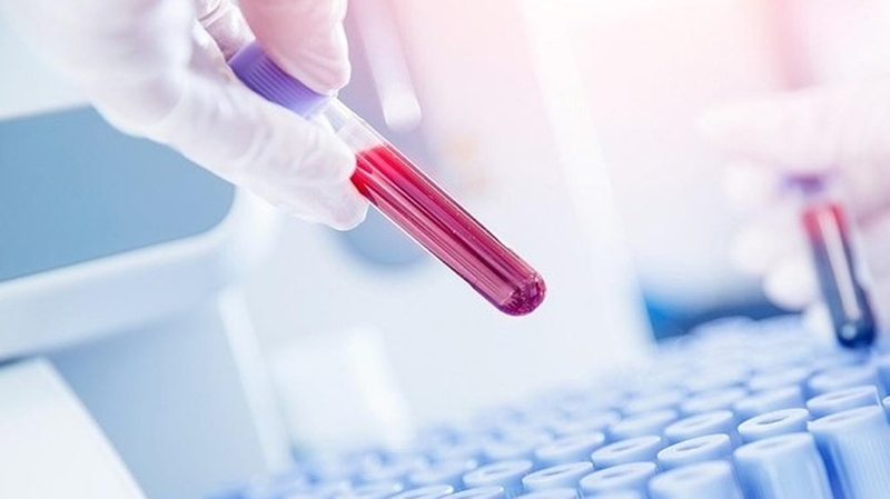 Xét nghiệm RPR là gì? Tại sao cần làm xét nghiệm RPR?+4