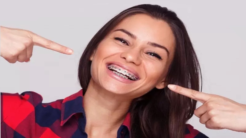 50 tuổi có nên niềng răng không? Cần lưu ý gì? 2