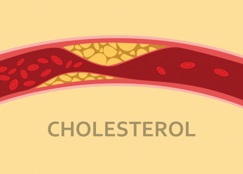 Nếu chúng ta có quá nhiều cholesterol, nó có thể dính vào thành trong của động mạch, thu hẹp chúng và làm tăng nguy cơ mắc bệnh tim mạch