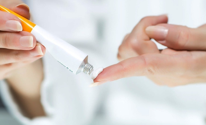 Để kiểm soát sự phát triển của nấm men, người bệnh có thể sử dụng các loại xà phòng tắm hay kem bôi tại chỗ không cần kê toa