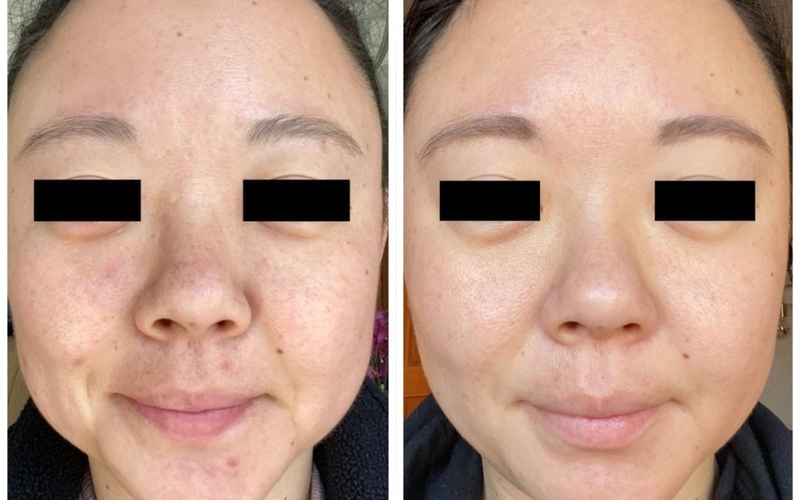 5 cách đẩy nhanh quá trình tái tạo da - Chị em không thể bỏ qua! 2