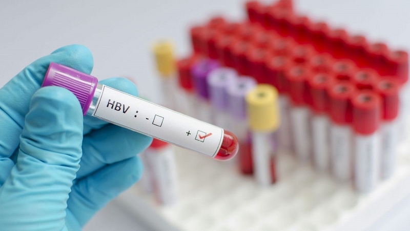 Giải thích ý nghĩa của 5 chỉ số viêm gan B 3