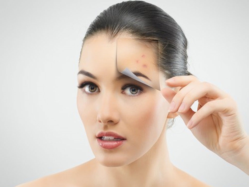 kem nen cho da dau mun 1