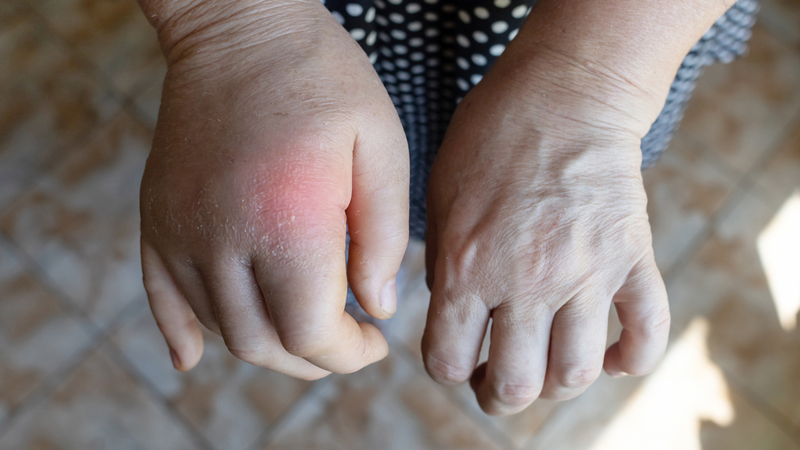 5 Lợi ích sức khỏe của chế độ ăn ít natri 4