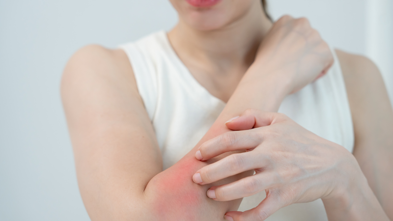 Người có cơ địa dị ứng cần đặc biệt cẩn trọng khi ăn hạt chia