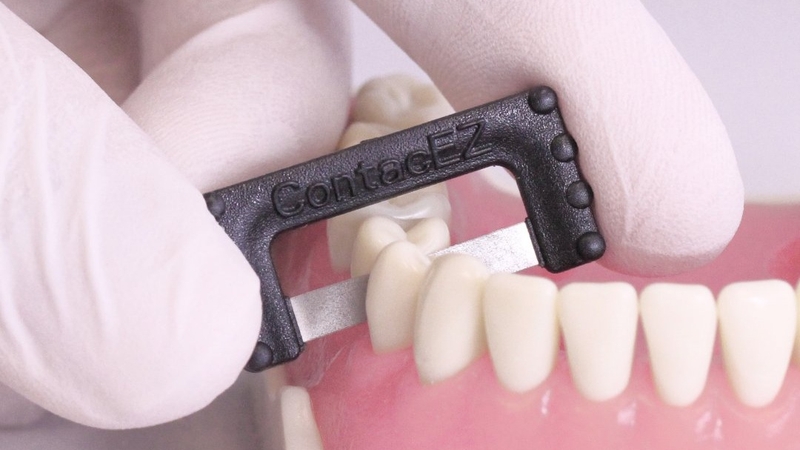 5 sự thật về phương pháp mài kẽ răng - Đọc ngay! 1