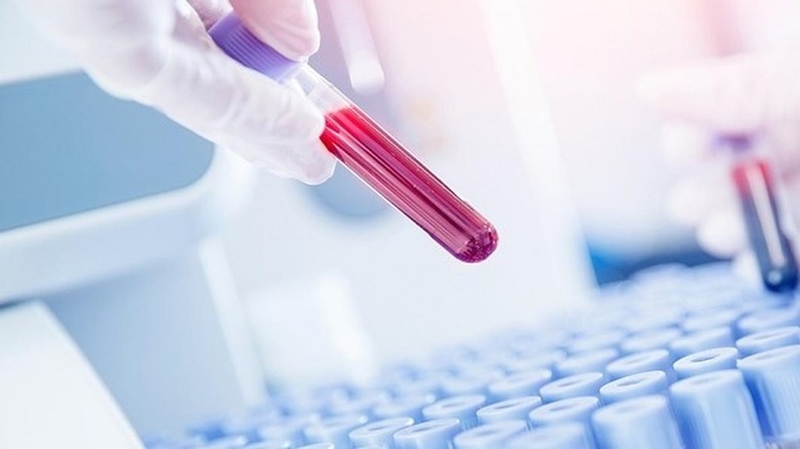 Tại sao cần làm xét nghiệm GBS? Ý nghĩa của xét nghiệm GBS đối với phụ nữ có thai như thế nào?+5