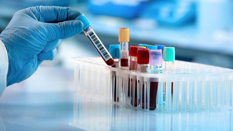 Xét nghiệm CEA - Phương pháp chẩn đoán các bệnh ung thư +5