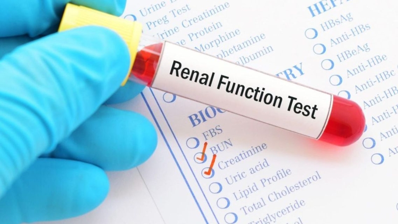Mỗi loại xét nghiệm sẽ yêu cầu chuẩn bị khác nhau