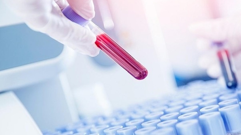 Xét nghiệm INR - Phương pháp đánh giá tình trạng đông máu+5