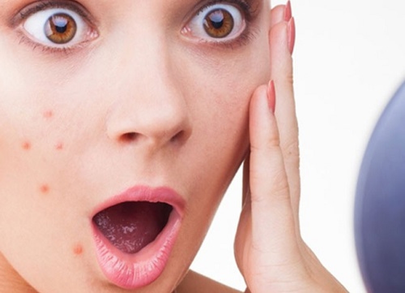 Cách xử lý khi gặp phải tình trạng dị ứng da mặt sần sùi 2