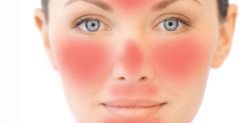 Làm dịu da bị cháy nắng hoặc kích ứng