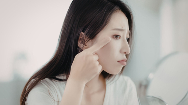 Thâm quầng mắt liên quan đến tăng sắc tố, giãn mạch dưới da hoặc ứ trệ tuần hoàn vi mạch