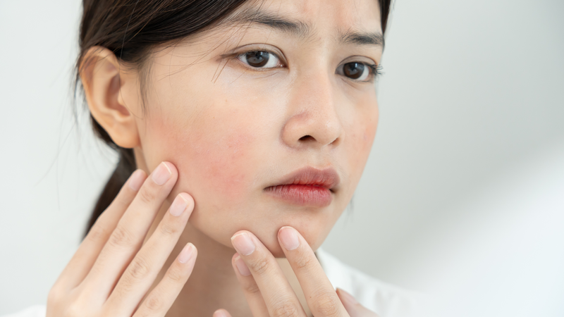 Da mỏng và dễ tổn thương hơn có thể là dấu hiệu của quá trình lão hóa