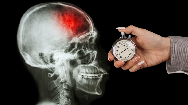 6 điều cần làm và 3 điều không nên khi phát hiện người đột quỵ 3