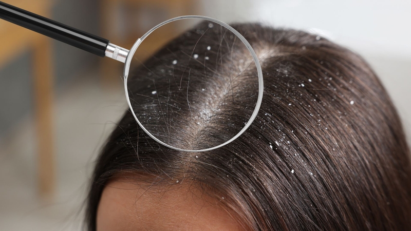 6 lợi ích bất ngờ của quế đối với mái tóc 2