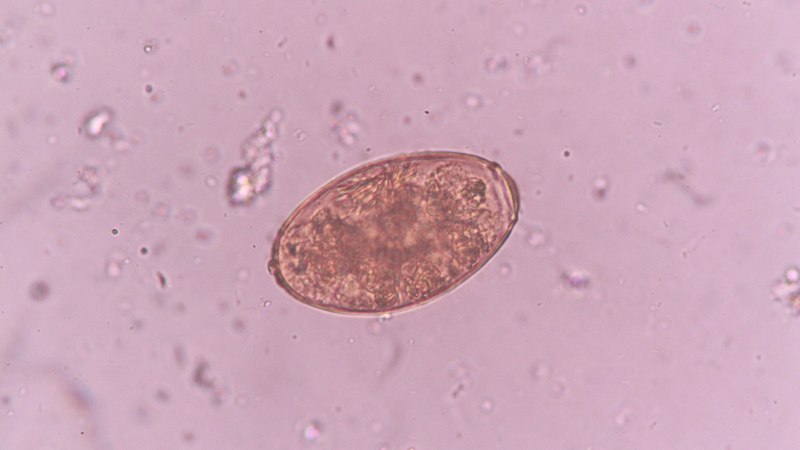 6 món gỏi sống dễ nhiễm sán lá phổi và nhiều ký sinh trùng khác 1