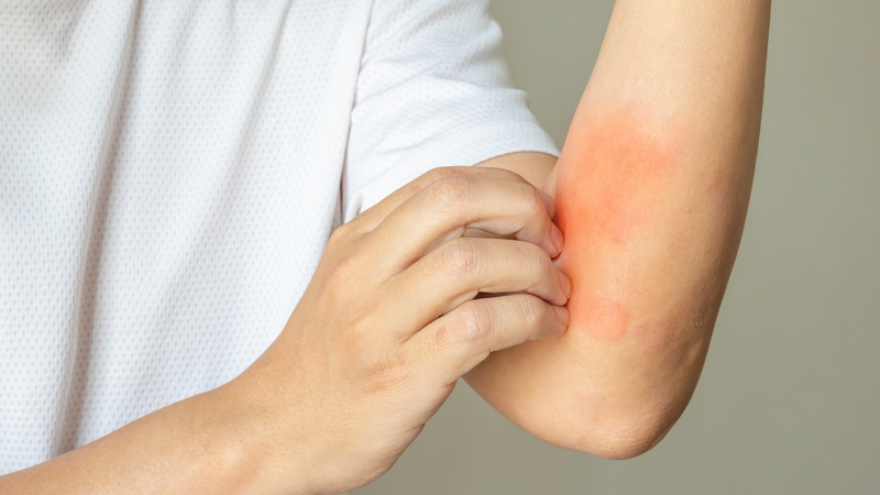 6 tác hại khi ăn quá nhiều bắp cải mà bạn nên biết 3