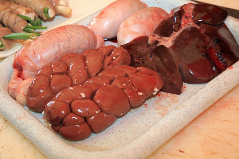 Có sỏi cholesterol trong túi mật nên làm như thế nào? -4