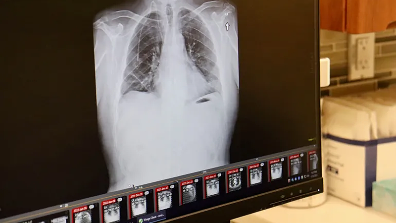 7 biện pháp cần làm ngay để phòng ngừa ung thư hiệu quả 1