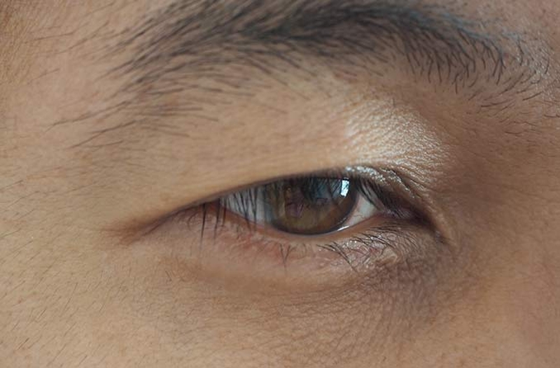 7 cách massage mắt giảm sụp mí vô cùng đơn giản và hiệu quả 1