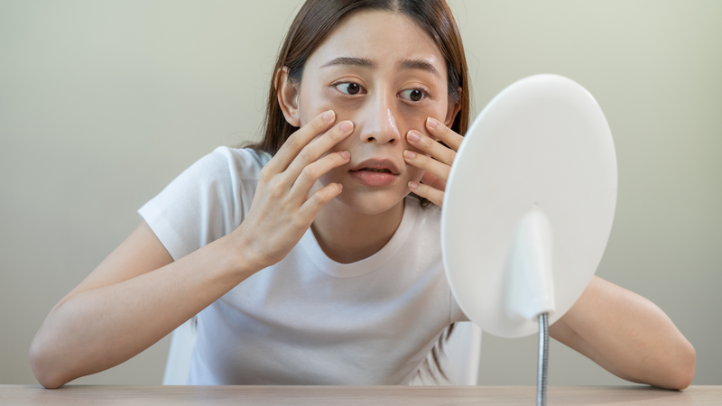 Stress thường đi kèm với tình trạng mất ngủ hoặc ngủ không sâu giấc gây quầng thâm và bọng mắt rõ hơn