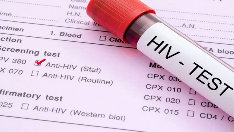 7 dấu hiệu nhiễm HIV ban đầu ở nam giới: Nhận biết để điều trị 4