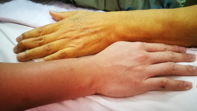 Cây Vọng cách – loài rau bảo vệ gan 7