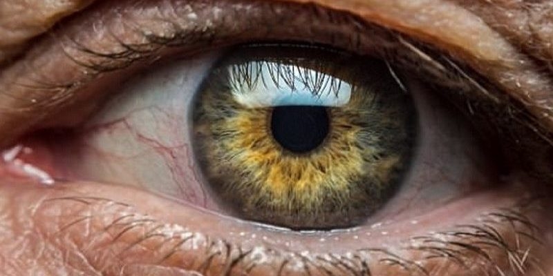 Thoái hóa điểm vàng thể ướt: Triệu chứng và nguyên nhân gây ra bệnh 1