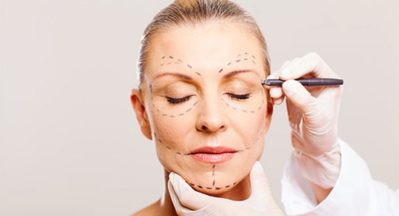 Căng da mặt bằng chỉ có thể để lại một số biến chứng tùy theo cơ địa và địa chỉ thẩm mỹ bạn lựa chọn